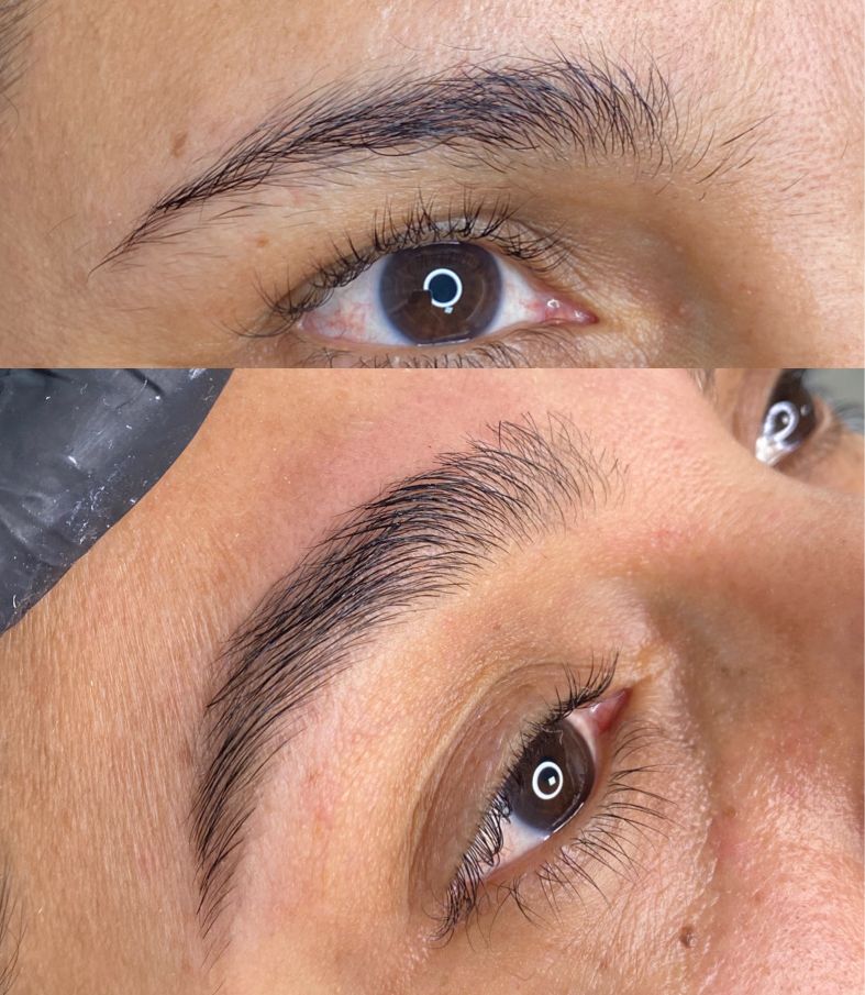 Antes e depois: reconstrução de sobrancelhas com o Método Fio Vivo